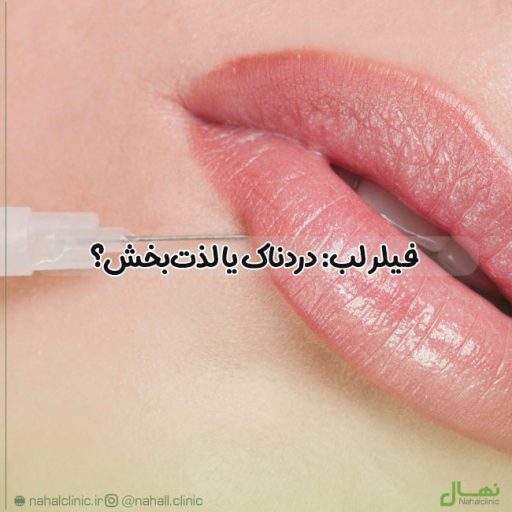فیلر لب: دردناک یا لذت‌بخش؟ چقدر واقعاً به زیبایی شما کمک می‌کند؟