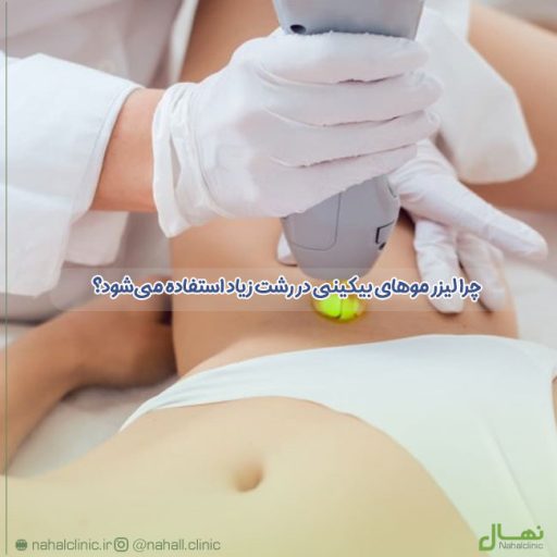 چرا لیزر موهای بیکینی در رشت زیاد استفاده می‌شود؟