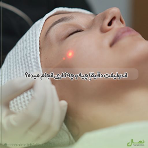 اندولیفت دقیقاً چیه و چه کاری انجام میده؟