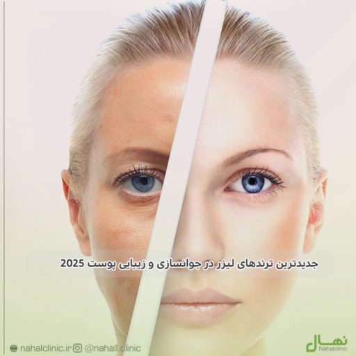 جدیدترین ترندهای لیزر در جوانسازی و زیبایی پوست ۲۰۲۵