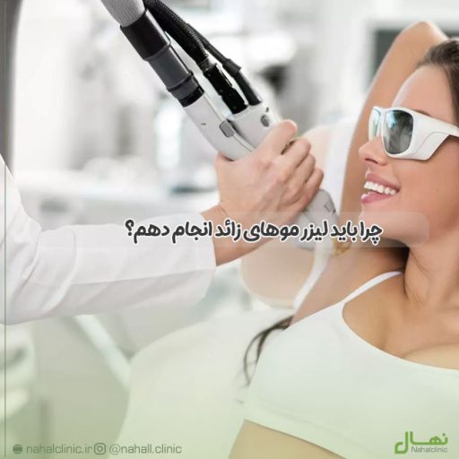 چرا باید لیزر موهای زائد انجام دهم؟