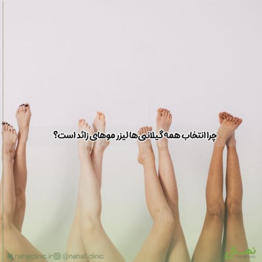 چرا انتخاب همه گیلانی‌ها لیزر موهای زائد است؟